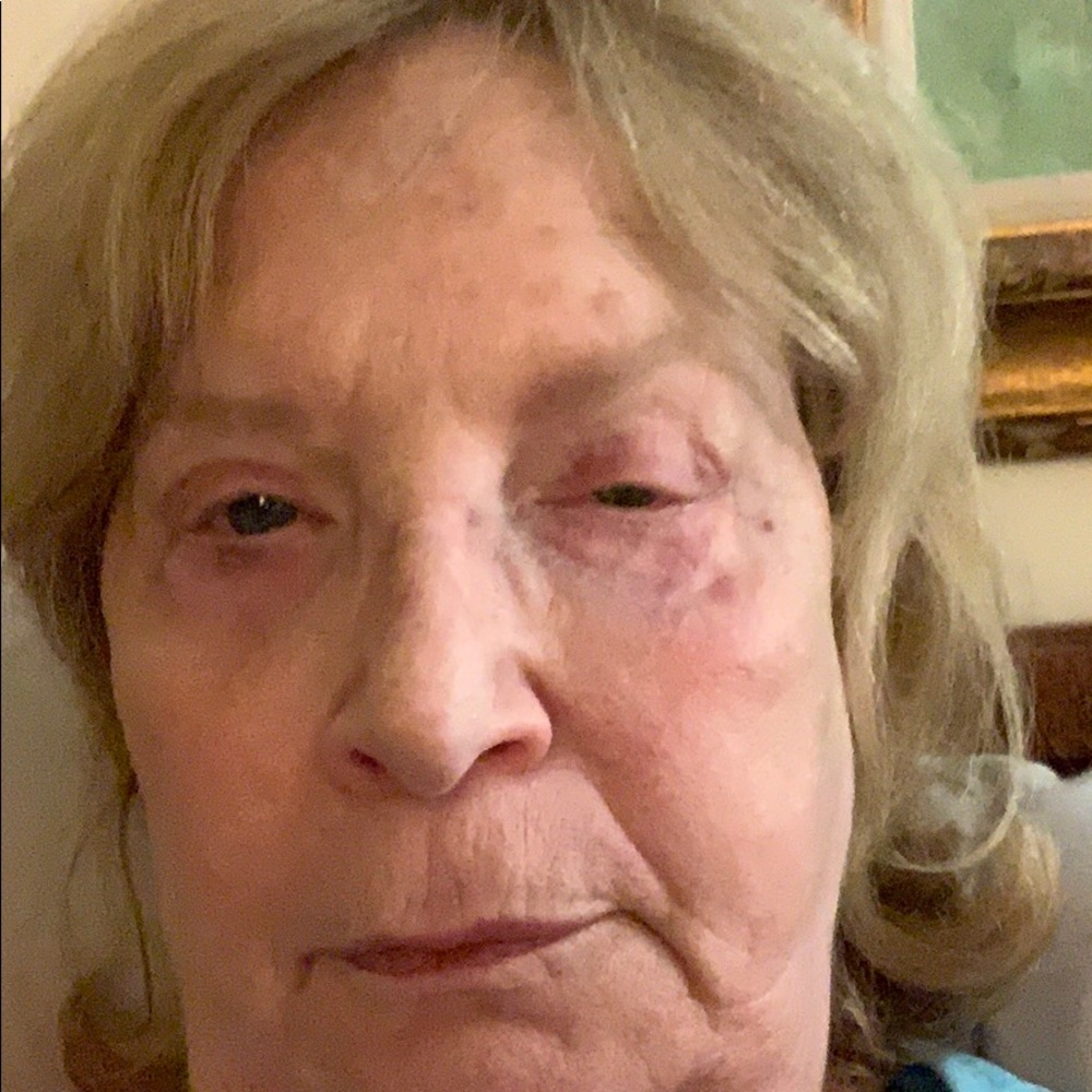 Meet your Posher, Phyllis